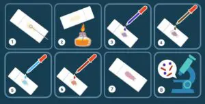 gram staining